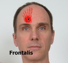 Frontalis trigger points