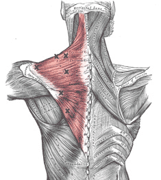 Common Trigger Points Example: Trapezius Muscle in Back